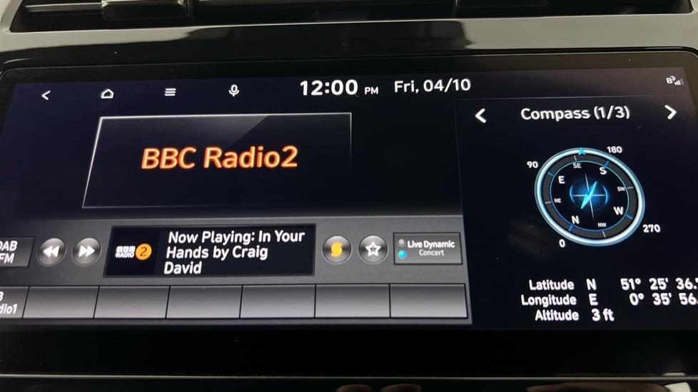 DAB Radio