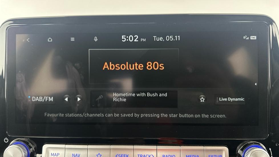 DAB Radio