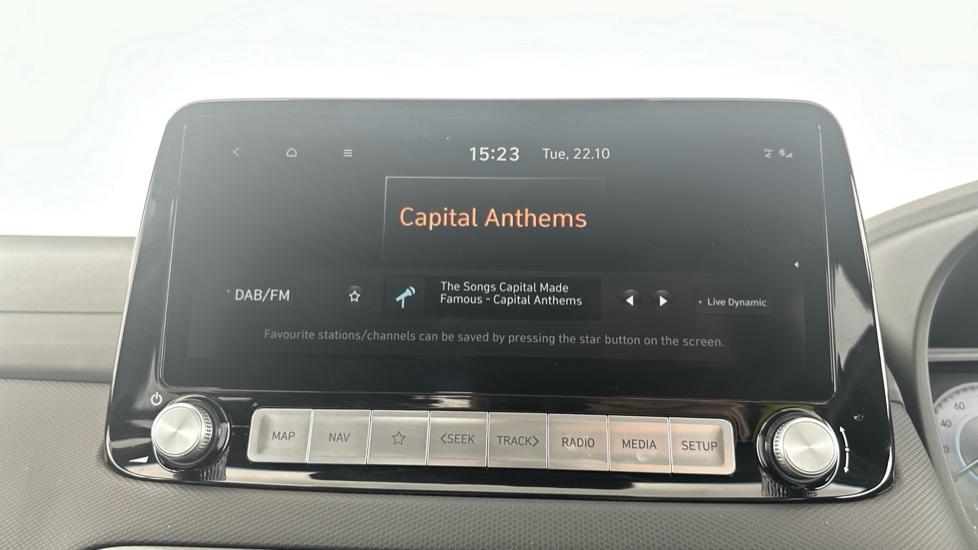 DAB Radio