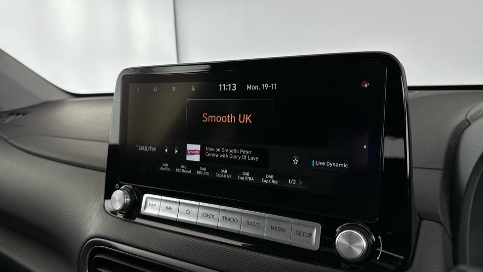 DAB Radio