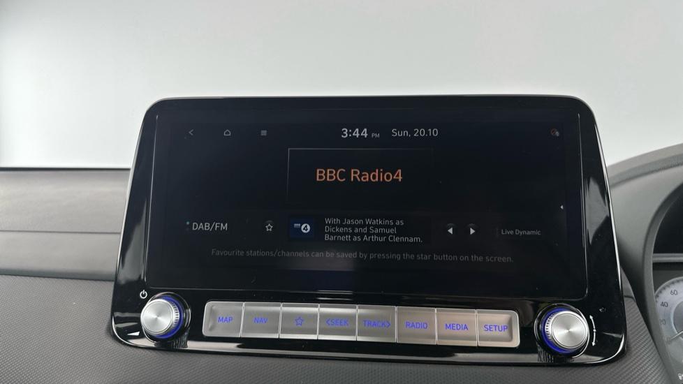 DAB Radio