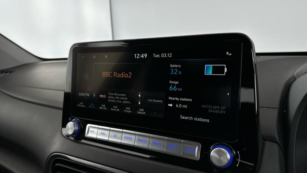 DAB Radio