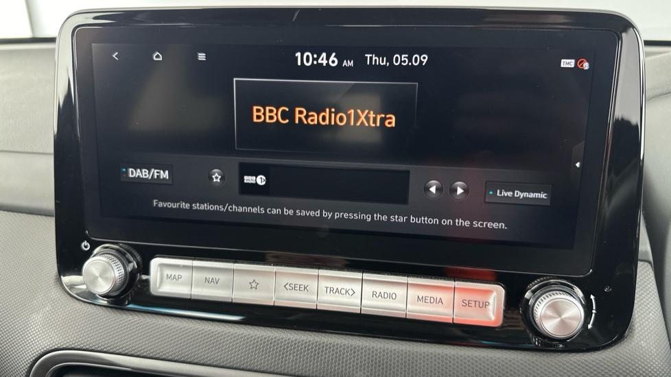 DAB Radio