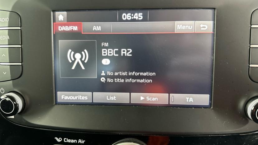 DAB Radio