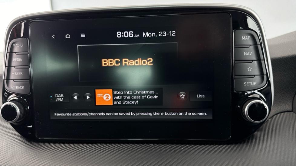 DAB Radio