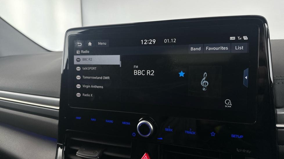 DAB Radio