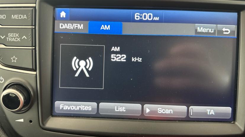 DAB Radio