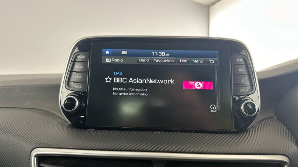 DAB Radio