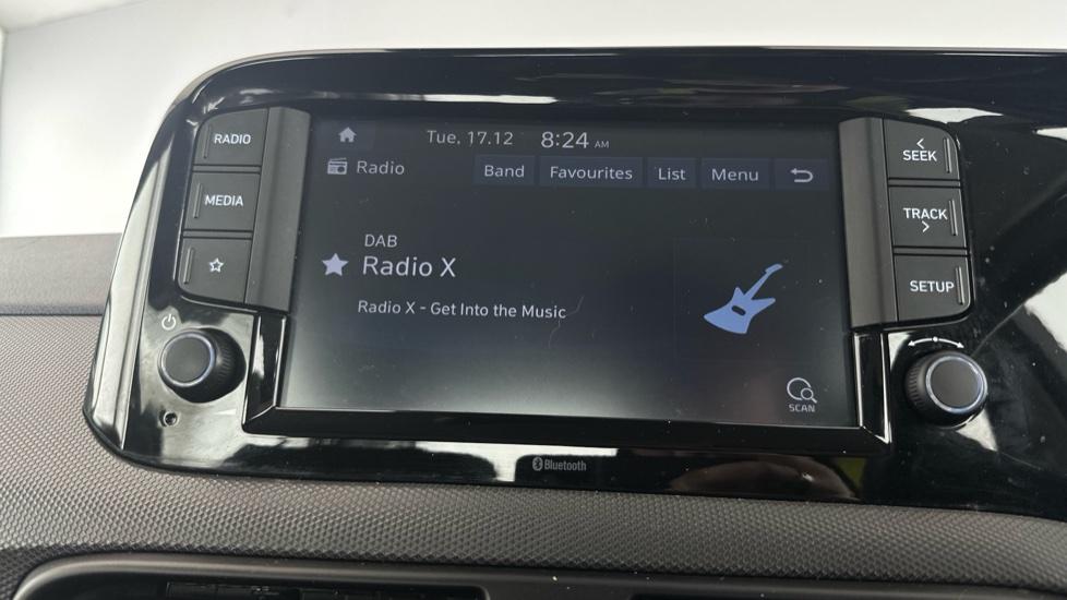 DAB Radio