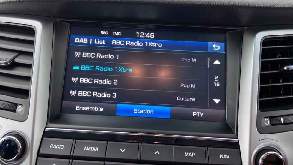 DAB radio 