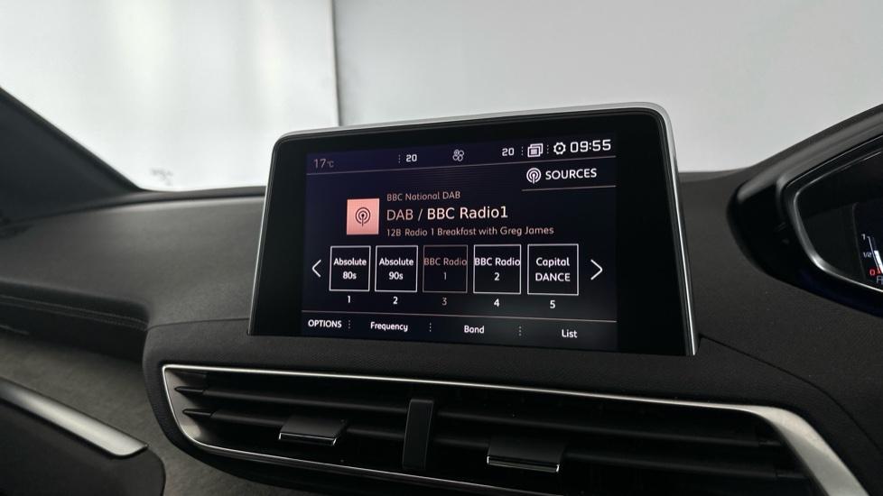 DAB Radio