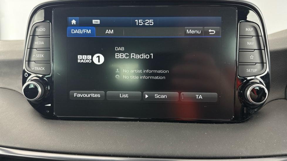 DAB Radio