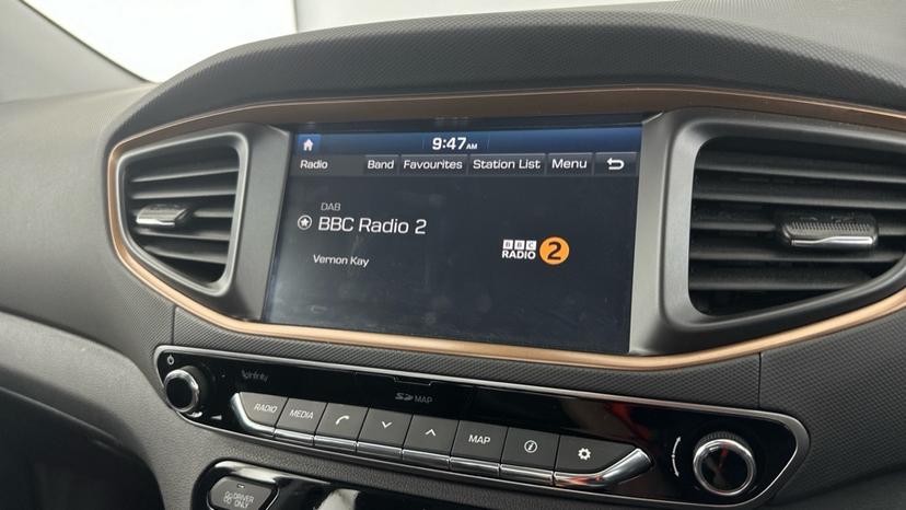 DAB Radio