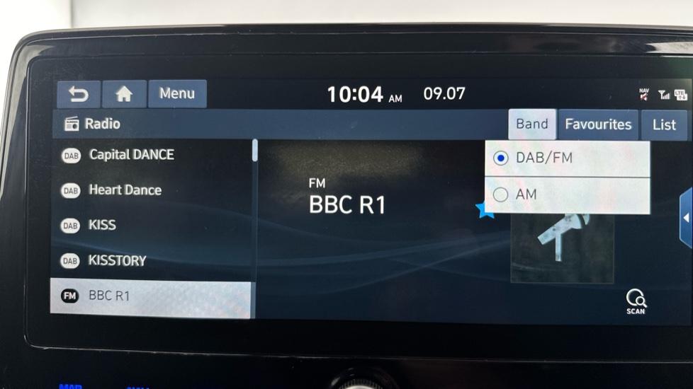 DAB Radio