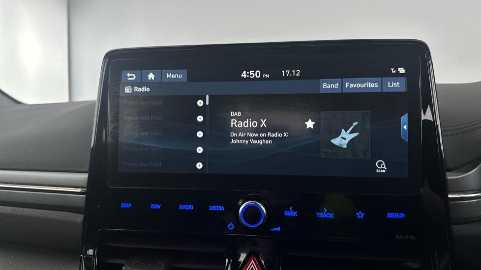 DAB Radio