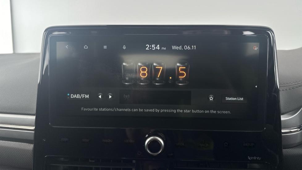 DAB Radio