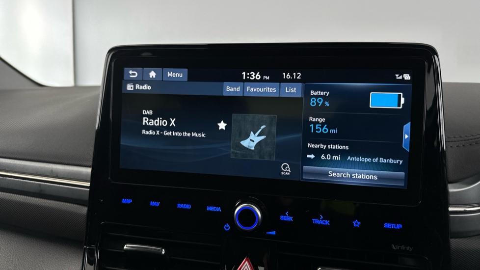 DAB Radio