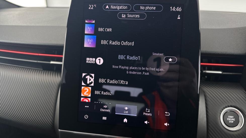 DAB Radio