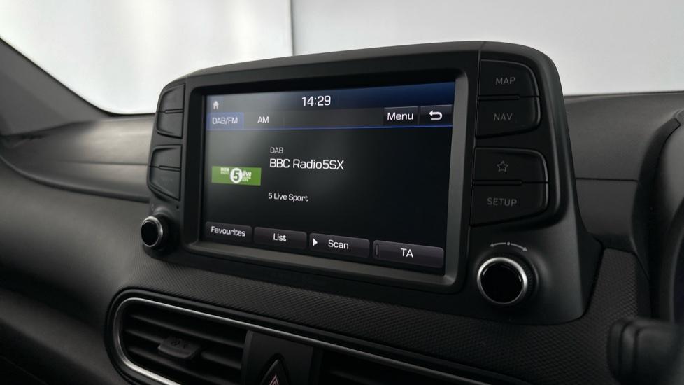 DAB Radio