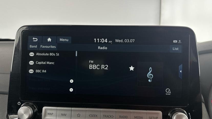 DAB Radio