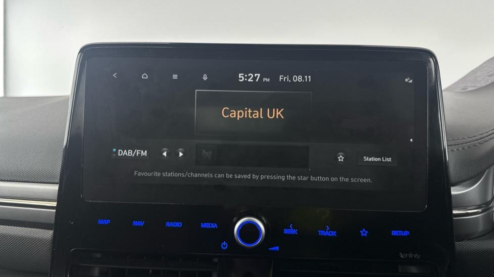 DAB Radio