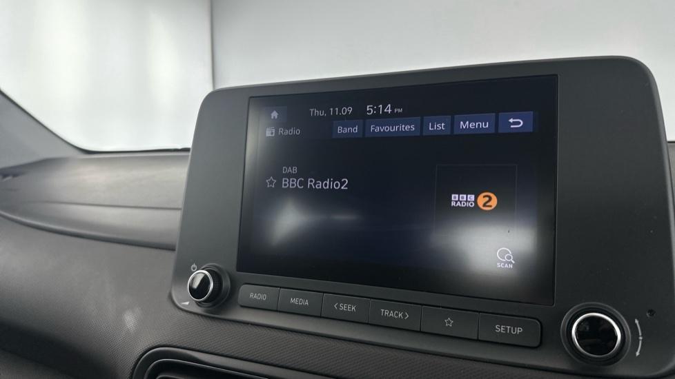 DAB Radio