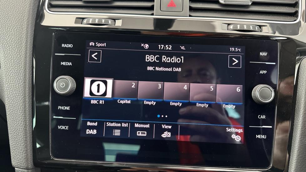 DAB Radio