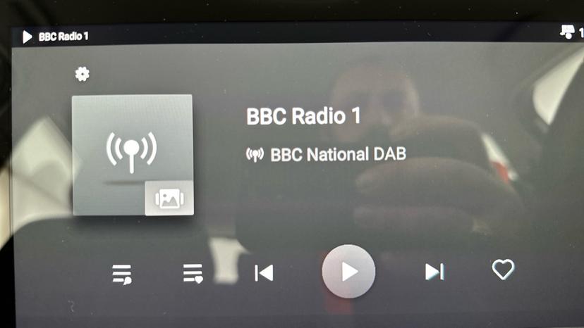 DAB Radio