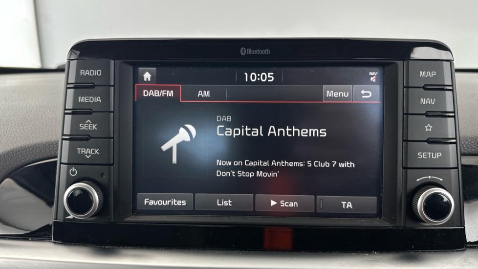 DAB Radio