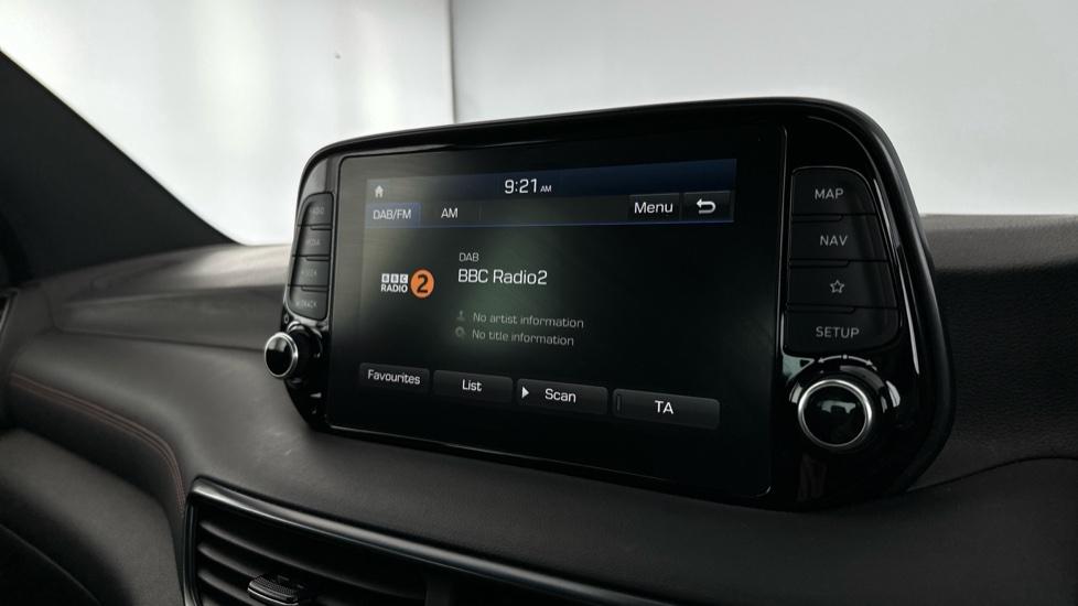 DAB Radio