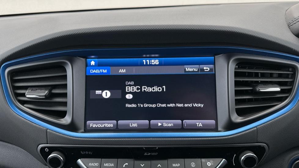 DAB Radio