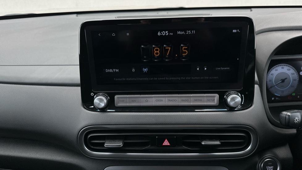 DAB Radio