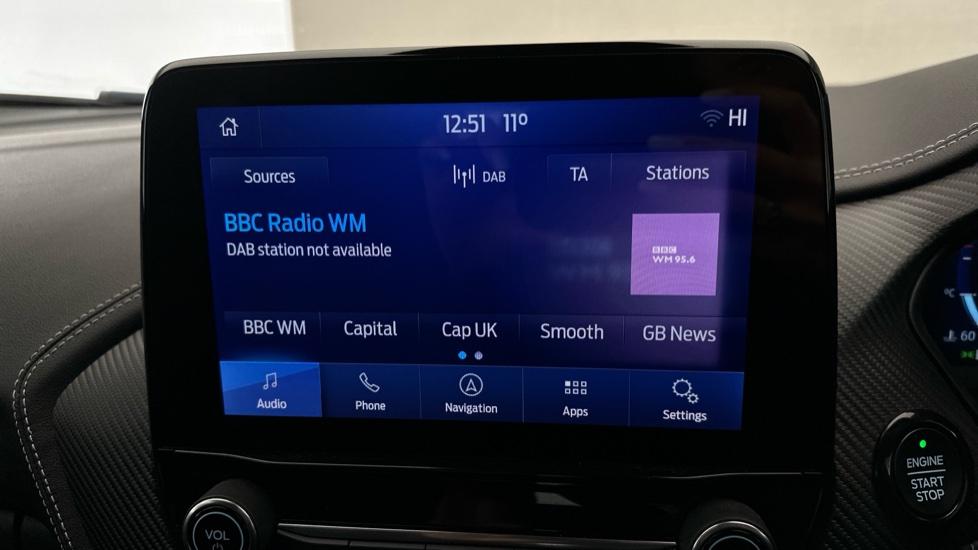 DAB Radio