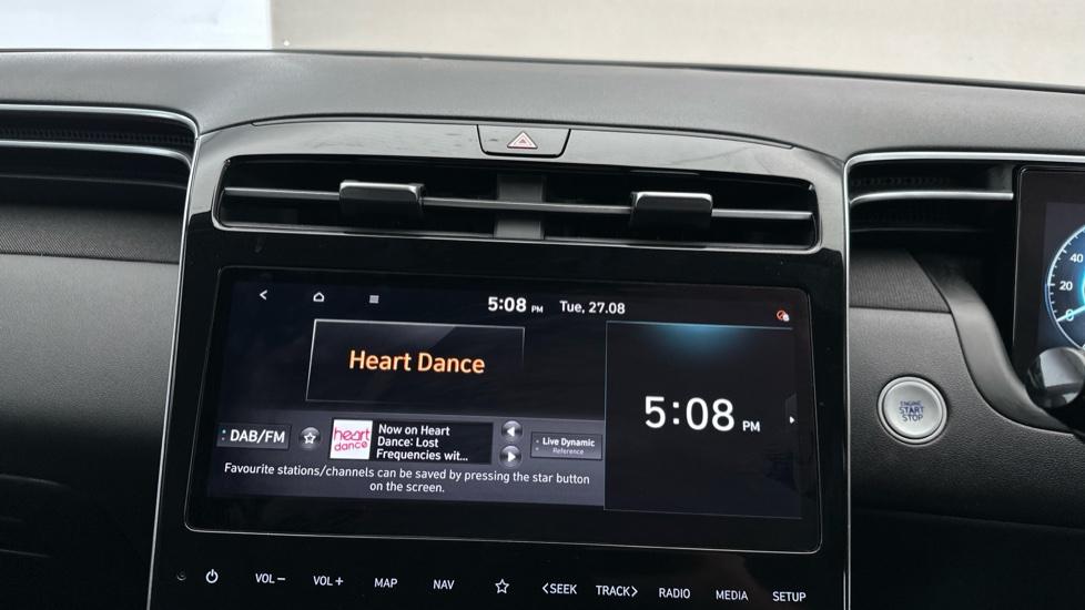 DAB Radio