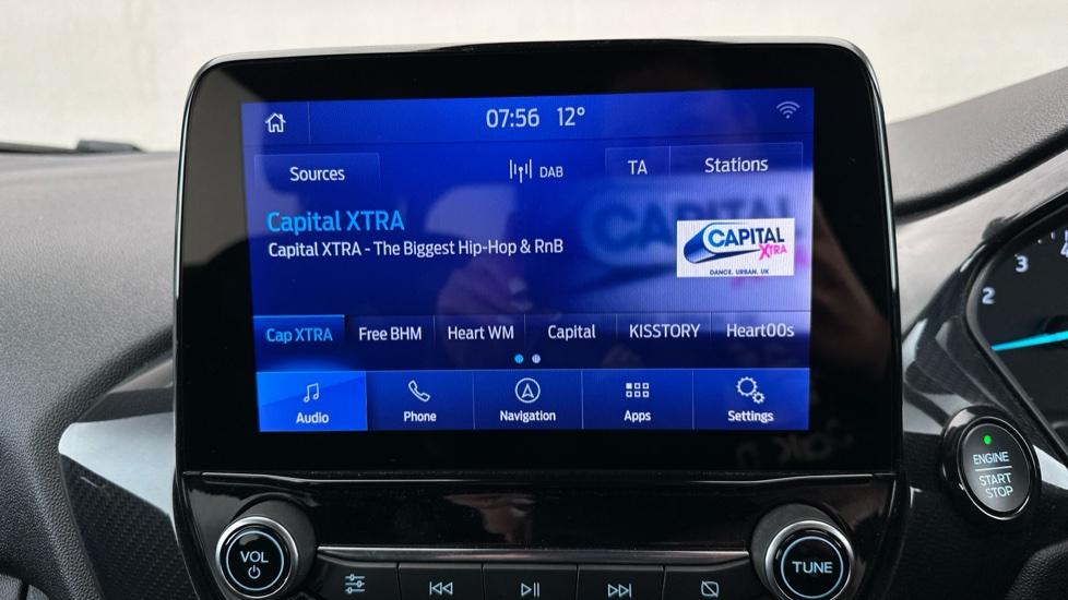 DAB Radio