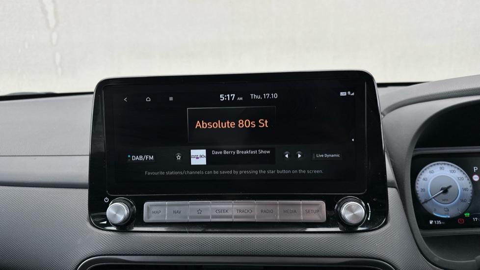 DAB Radio