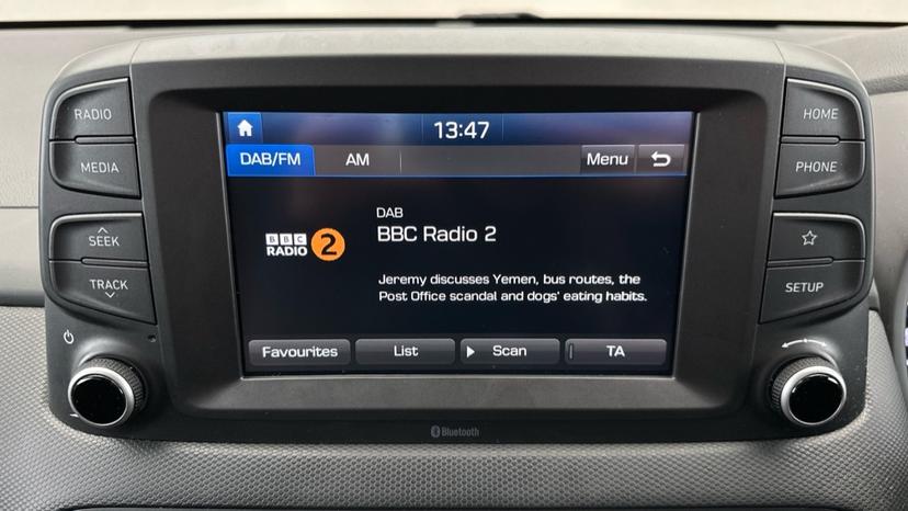 DAB Radio