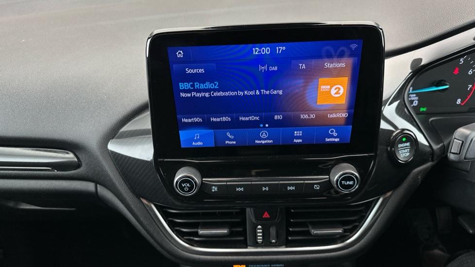 DAB Radio