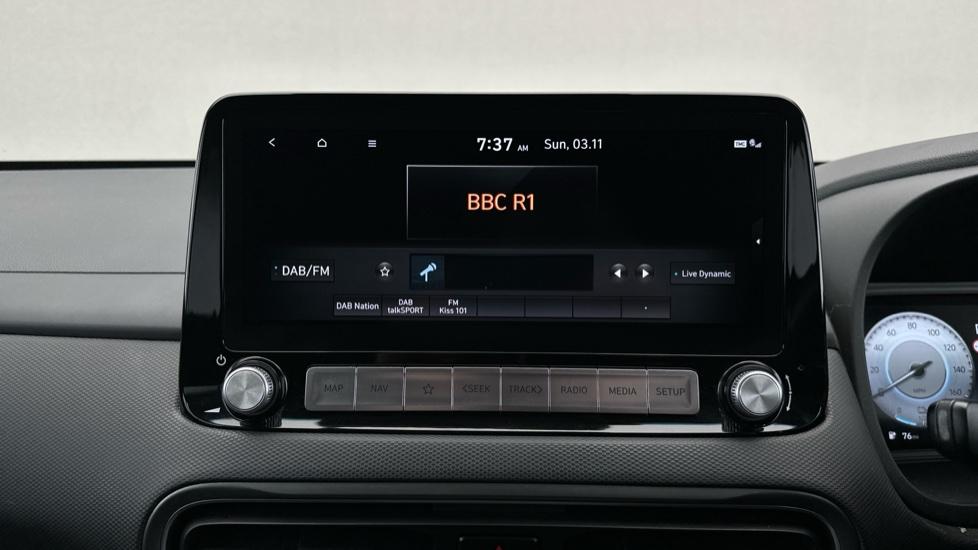 DAB Radio