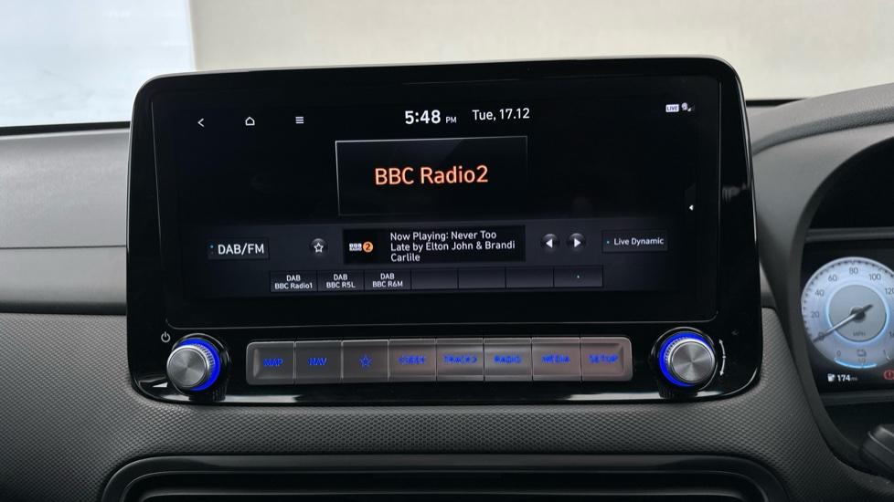 DAB Radio