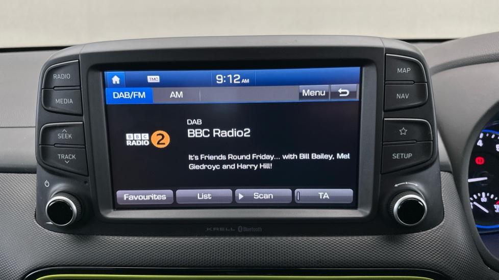 DAB Radio