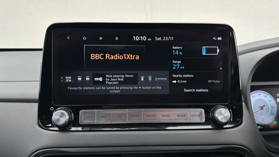 DAB Radio