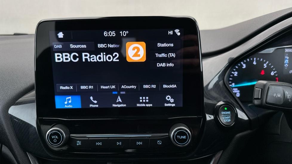 DAB Radio