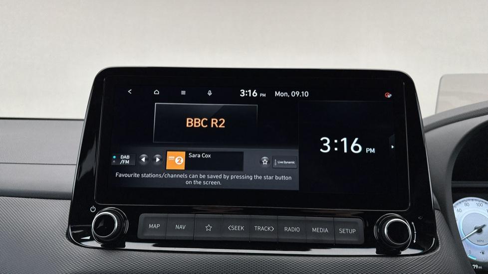 DAB Radio