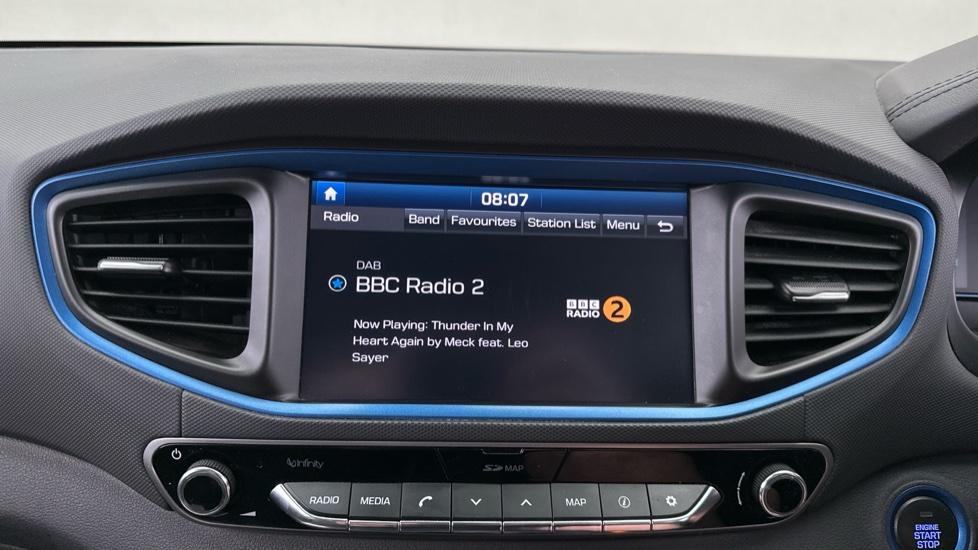 DAB Radio