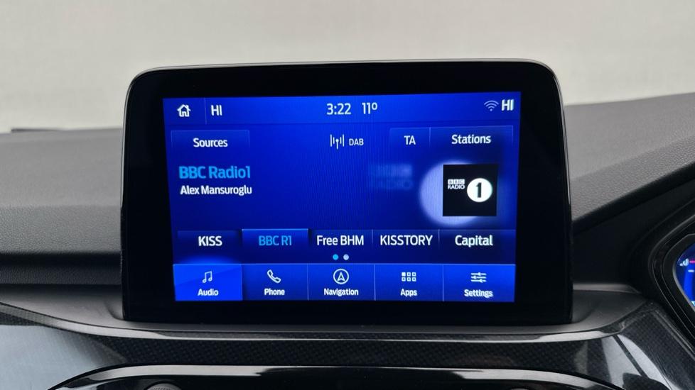 DAB Radio