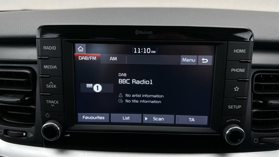 DAB Radio