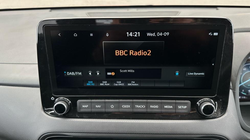 DAB Radio