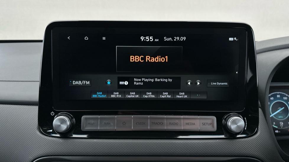 DAB Radio