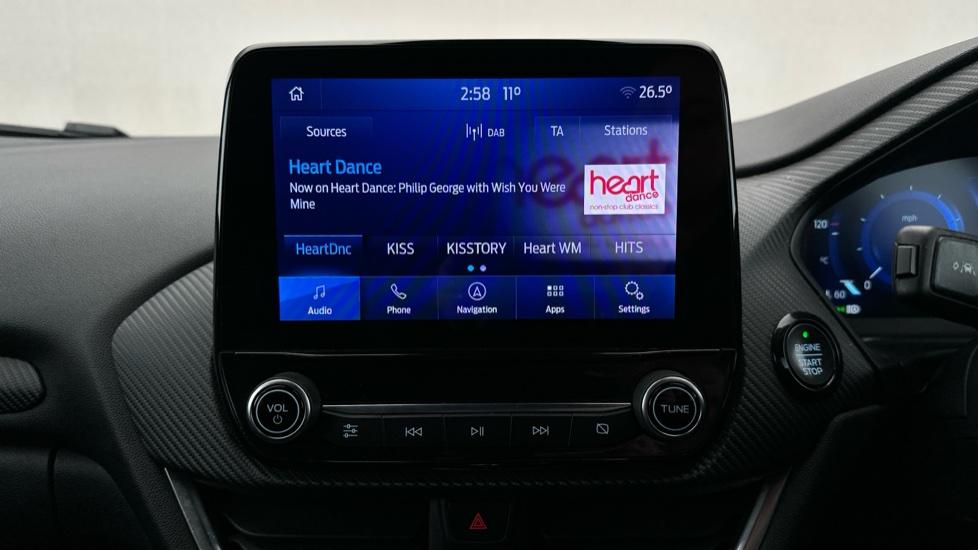 DAB Radio